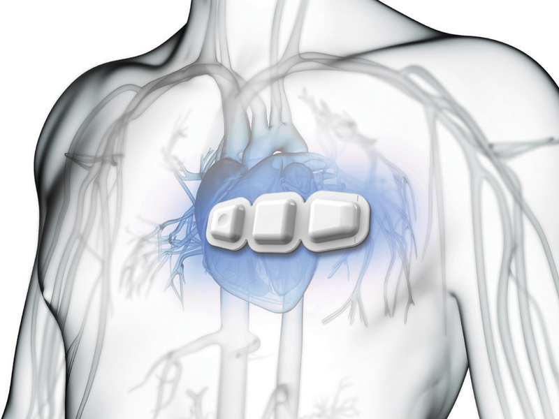 Real-Time Cardiac Analysis and Extended Existing Wearable ECG Data Recorder